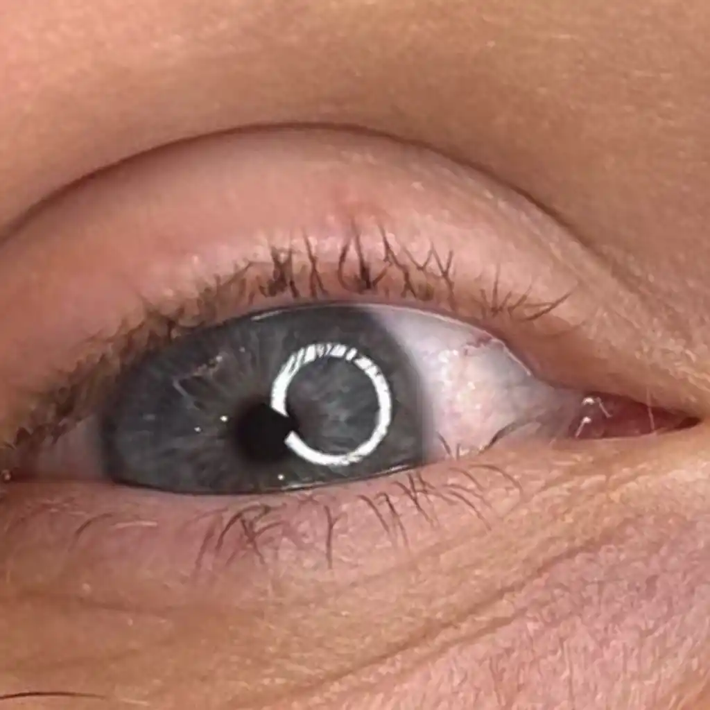 Résultat avant extension de cils Rehaussement de cils à Paris chez Essen'Cils